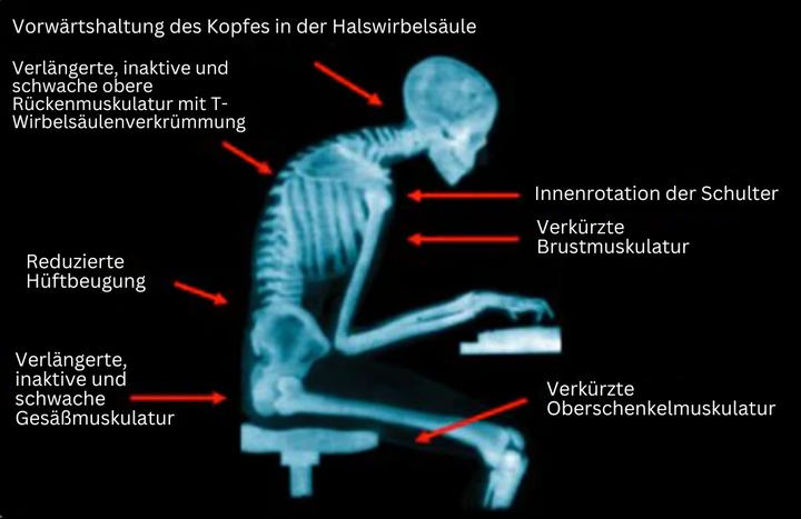 Holdningskorrigerer med EMS-teknologi for Bedre Rygghelse